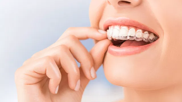 Invisalign®