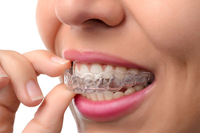 Dr. Jen s Gentle Dentistry | View All, Invisalign reg  and Gentle Dentistry