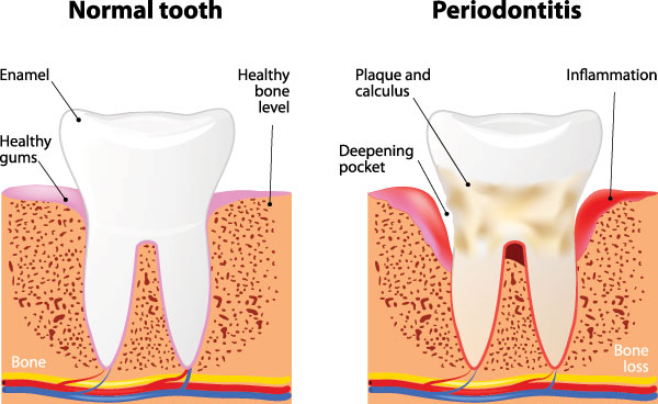 Dr. Jen s Gentle Dentistry | Invisalign reg , Oral Surgery and Children Pediatrics